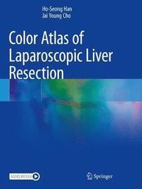 bokomslag Color Atlas of Laparoscopic Liver Resection