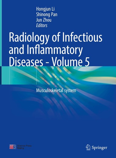 Hongjun Li, Shinong Pan, Jun Zhou - Radiology of Infectious and Inflammatory Diseases - Volume 5, Inbunden