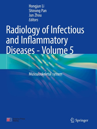 Hongjun Li, Shinong Pan, Jun Zhou - Radiology of Infectious and Inflammatory Diseases - Volume 5, Häftad