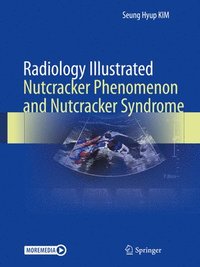 bokomslag Radiology Illustrated: Nutcracker Phenomenon and Nutcracker Syndrome