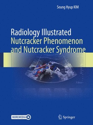 Radiology Illustrated: Nutcracker Phenomenon and Nutcracker Syndrome 1