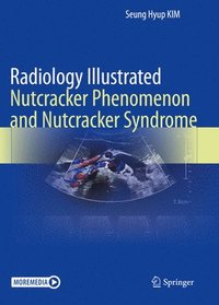 bokomslag Radiology Illustrated: Nutcracker Phenomenon and Nutcracker Syndrome