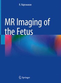 bokomslag MR Imaging of the Fetus