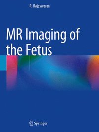 bokomslag MR Imaging of the Fetus