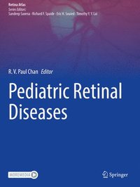 bokomslag Pediatric Retinal Diseases