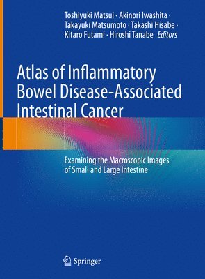 Atlas of Inflammatory Bowel Disease-Associated Intestinal Cancer