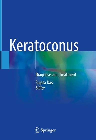 Sujata Das - Keratoconus, Inbunden