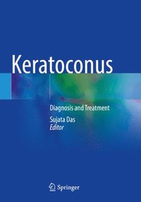 bokomslag Keratoconus