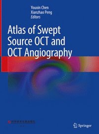 bokomslag Atlas of Swept Source OCT and OCT Angiography