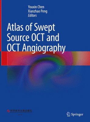 bokomslag Atlas of Swept Source OCT and OCT Angiography