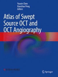 bokomslag Atlas of Swept Source OCT and OCT Angiography