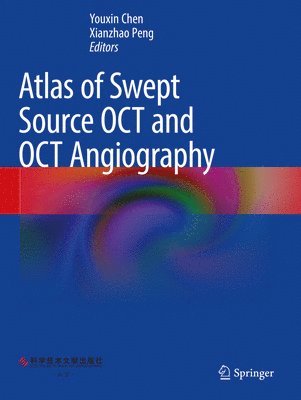 bokomslag Atlas of Swept Source OCT and OCT Angiography