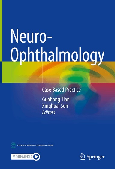 Guohong Tian, Xinghuai Sun - Neuro-Ophthalmology, Inbunden