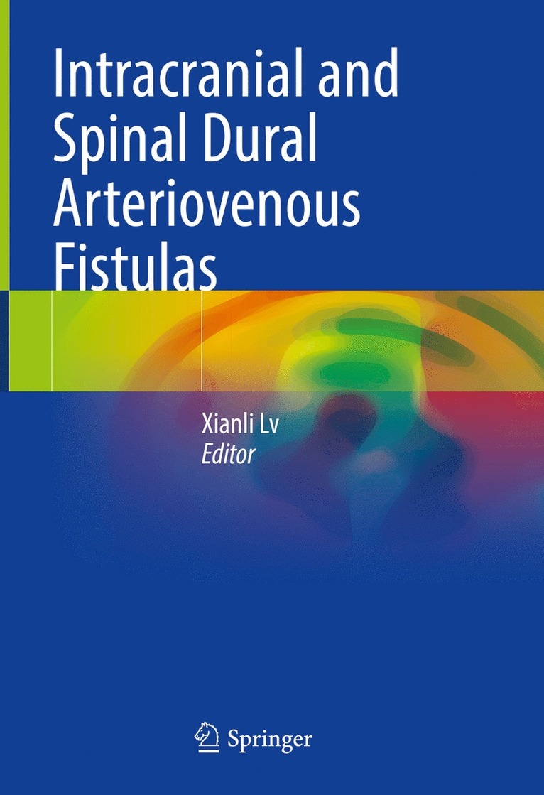 Intracranial and Spinal Dural Arteriovenous Fistulas 1