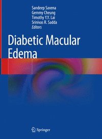 bokomslag Diabetic Macular Edema