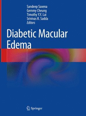 bokomslag Diabetic Macular Edema