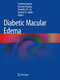 bokomslag Diabetic Macular Edema