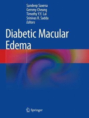 Diabetic Macular Edema 1