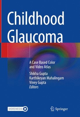 bokomslag Childhood Glaucoma