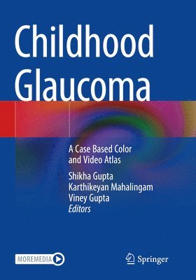 bokomslag Childhood Glaucoma