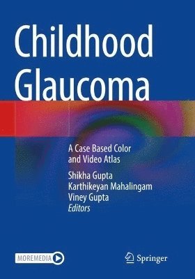 Shikha Gupta, Karthikeyan Mahalingam, Viney Gupta - Childhood Glaucoma, Häftad