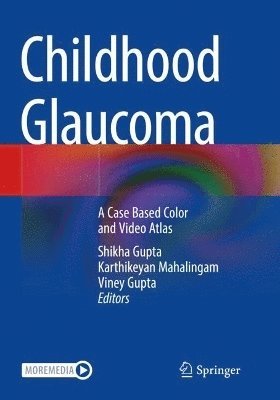 Childhood Glaucoma 1