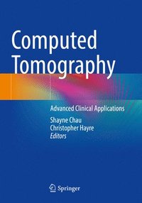 bokomslag Computed Tomography