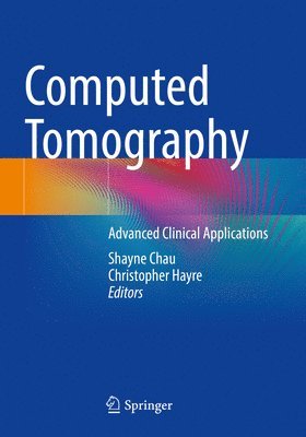 Computed Tomography 1