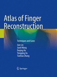 bokomslag Atlas of Finger Reconstruction