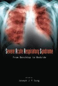 bokomslag Severe Acute Respiratory Syndrome (Sars): From Benchtop To Bedside