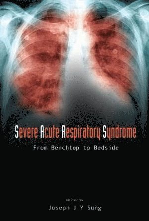 bokomslag Severe Acute Respiratory Syndrome (Sars): From Benchtop To Bedside