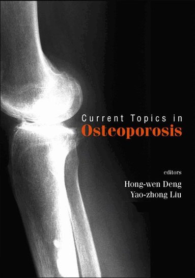 DENG HONG-WEN, Hong-wen Deng, Yao-zhong Liu, Chun-yuan Guo, Di Chen - CURRENT TOPICS IN OSTEOPOROSIS, Inbunden