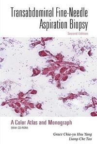 bokomslag Transabdominal Fine-needle Aspiration Biopsy (2nd Edition): A Color Atlas And Monograph (With Cd-rom)
