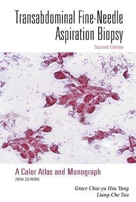 bokomslag Transabdominal Fine-needle Aspiration Biopsy (2nd Edition): A Color Atlas And Monograph (With Cd-rom)