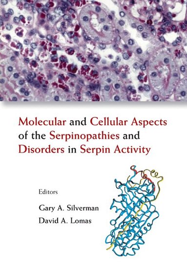 SILVERMAN GARY A, Gary A Silverman, David A Lomas - MOLECULAR AND CELLULAR ASPECTS OF THE SERPINOPATHIES AND DISORDERS IN SERPIN ACTIVITY, Inbunden