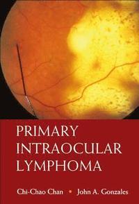 bokomslag Primary Intraocular Lymphoma