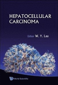 bokomslag Hepatocellular Carcinoma