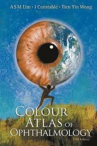 bokomslag Colour Atlas Of Ophthalmology (Fifth Edition)