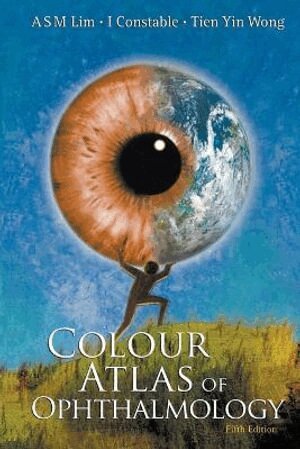 Arthur SM Lim, Ian J Constable, Tien Yin Wong - COLOUR ATLAS OF OPHTHALMOLOGY (FIFTH EDITION), Häftad