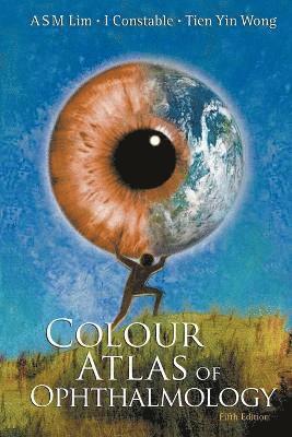 Colour Atlas Of Ophthalmology (Fifth Edition) 1