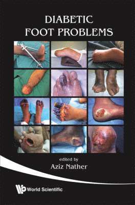 NATHER AZIZ, Abdul Aziz Nather, S'pore) Nather, Abdul Aziz (National Univ Health System - Diabetic Foot Problems, Häftad
