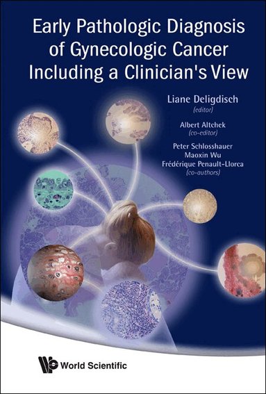 Liane Deligdisch, Peter Schlosshauer, Maoxin Wu, Albert Altchek, Frédérique Penault-Llorca - EARLY PATHOLOGIC DIAGNOSIS OF GYNECOLOGIC CANCER INCLUDING A CLINICIAN'S VIEW, Inbunden