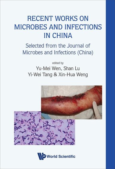Wen Yu-Mei, Yu-Mei Wen, Shan Lu, Yi-Wei Tang, Xin-Hua Weng - RECENT WORKS ON MICROBES AND INFECTIONS IN CHINA: SELECTED FROM THE JOURNAL OF MICROBES AND INFECTIONS (CHINA), Inbunden