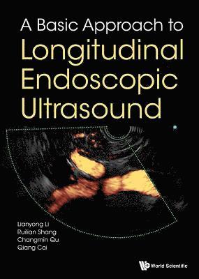 Basic Approach To Longitudinal Endoscopic Ultrasound, A 1