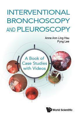 Interventional Bronchoscopy And Pleuroscopy: A Book Of Case Studies With Videos 1