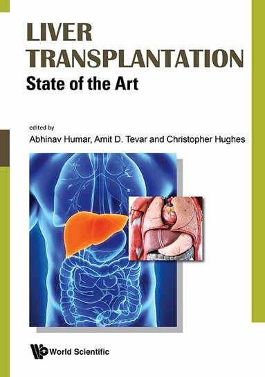Humar Abhinav, Abhinav Humar, Amit Tevar, Christopher Hughes - LIVER TRANSPLANTATION: STATE OF THE ART, Inbunden