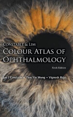 Ian J Constable, Tien Yin Wong, Vignesh Raja - CONSTABLE & LIM COLOUR ATLAS OF OPHTHALMOLOGY (SIXTH EDITION), Inbunden