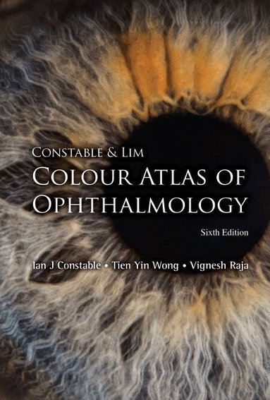 Ian J Constable, Tien Yin Wong, Vignesh Raja - CONSTABLE & LIM COLOUR ATLAS OF OPHTHALMOLOGY (SIXTH EDITION), Häftad