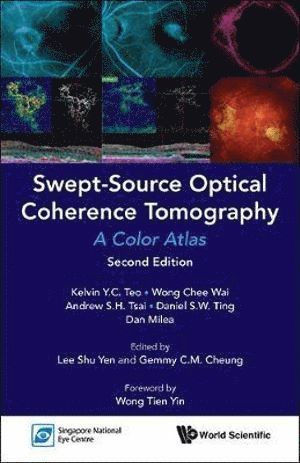 Swept-source Optical Coherence Tomography: A Color Atlas
