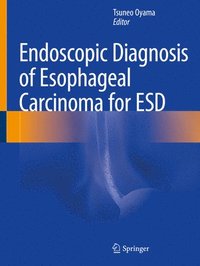 bokomslag Endoscopic Diagnosis of Esophageal Carcinoma for ESD